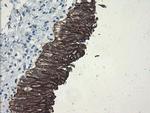 SLA2 Antibody in Immunohistochemistry (Paraffin) (IHC (P))