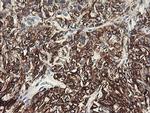 SLA2 Antibody in Immunohistochemistry (Paraffin) (IHC (P))