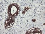 SLA2 Antibody in Immunohistochemistry (Paraffin) (IHC (P))