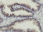 SLA2 Antibody in Immunohistochemistry (Paraffin) (IHC (P))