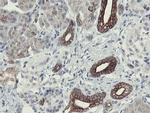 SLA2 Antibody in Immunohistochemistry (Paraffin) (IHC (P))