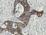 SLA2 Antibody in Immunohistochemistry (Paraffin) (IHC (P))