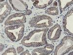 SLA2 Antibody in Immunohistochemistry (Paraffin) (IHC (P))