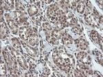 OTUB1 Antibody in Immunohistochemistry (Paraffin) (IHC (P))