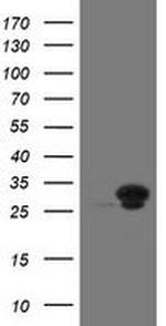 UBE2S Antibody in Western Blot (WB)