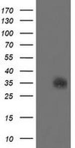 SDSL Antibody in Western Blot (WB)