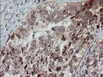 MRPS34 Antibody in Immunohistochemistry (Paraffin) (IHC (P))