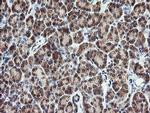 PIK3CG Antibody in Immunohistochemistry (Paraffin) (IHC (P))