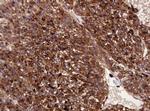 ATP6V1B2 Antibody in Immunohistochemistry (Paraffin) (IHC (P))