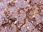 ATP6V1B2 Antibody in Immunohistochemistry (Paraffin) (IHC (P))