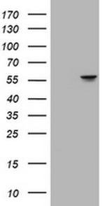 ATP6V1B2 Antibody in Western Blot (WB)