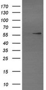 TRIM22 Antibody in Western Blot (WB)