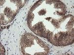 UBE2G2 Antibody in Immunohistochemistry (Paraffin) (IHC (P))