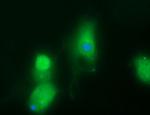 B3GNT2 Antibody in Immunocytochemistry (ICC/IF)