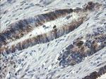 B3GNT2 Antibody in Immunohistochemistry (Paraffin) (IHC (P))