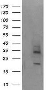 MAGEA4 Antibody in Western Blot (WB)