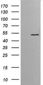 ETS2 Antibody in Western Blot (WB)