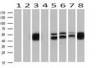 ETS2 Antibody in Western Blot (WB)