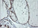 CMPK1 Antibody in Immunohistochemistry (Paraffin) (IHC (P))