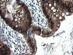 CMPK1 Antibody in Immunohistochemistry (Paraffin) (IHC (P))