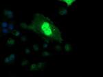 ETS2 Antibody in Immunocytochemistry (ICC/IF)