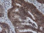 KIF25 Antibody in Immunohistochemistry (Paraffin) (IHC (P))