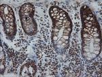 KIF25 Antibody in Immunohistochemistry (Paraffin) (IHC (P))