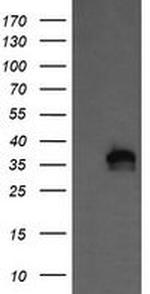 KIF25 Antibody in Western Blot (WB)