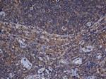 Alpha A Crystallin Antibody in Immunohistochemistry (Paraffin) (IHC (P))