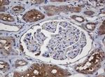 Alpha A Crystallin Antibody in Immunohistochemistry (Paraffin) (IHC (P))