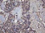 Alpha A Crystallin Antibody in Immunohistochemistry (Paraffin) (IHC (P))