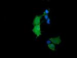 RhoJ Antibody in Immunocytochemistry (ICC/IF)