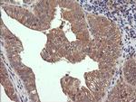 RhoJ Antibody in Immunohistochemistry (Paraffin) (IHC (P))