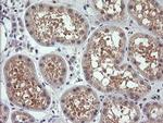 RhoJ Antibody in Immunohistochemistry (Paraffin) (IHC (P))