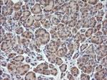 RhoJ Antibody in Immunohistochemistry (Paraffin) (IHC (P))