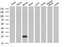 RhoJ Antibody in Western Blot (WB)