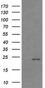 RhoJ Antibody in Western Blot (WB)