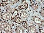 TRMT2A Antibody in Immunohistochemistry (Paraffin) (IHC (P))