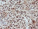 TRMT2A Antibody in Immunohistochemistry (Paraffin) (IHC (P))