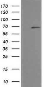 TRMT2A Antibody in Western Blot (WB)