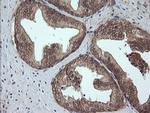 Alpha A Crystallin Antibody in Immunohistochemistry (Paraffin) (IHC (P))