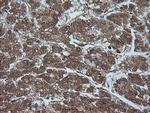 Alpha A Crystallin Antibody in Immunohistochemistry (Paraffin) (IHC (P))