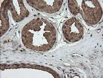 Alpha A Crystallin Antibody in Immunohistochemistry (Paraffin) (IHC (P))