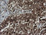 Alpha A Crystallin Antibody in Immunohistochemistry (Paraffin) (IHC (P))