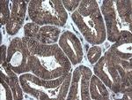 Alpha A Crystallin Antibody in Immunohistochemistry (Paraffin) (IHC (P))