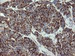 GBAS Antibody in Immunohistochemistry (Paraffin) (IHC (P))