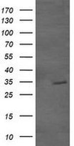 GBAS Antibody in Western Blot (WB)