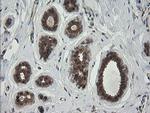 RhoJ Antibody in Immunohistochemistry (Paraffin) (IHC (P))