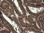 RhoJ Antibody in Immunohistochemistry (Paraffin) (IHC (P))