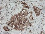 RhoJ Antibody in Immunohistochemistry (Paraffin) (IHC (P))